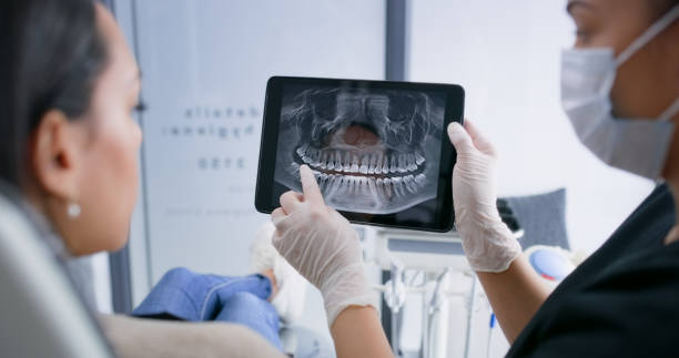 Licensed Root Canal Treatment service in Massapequa Park, NY - Smile Center Dentistry